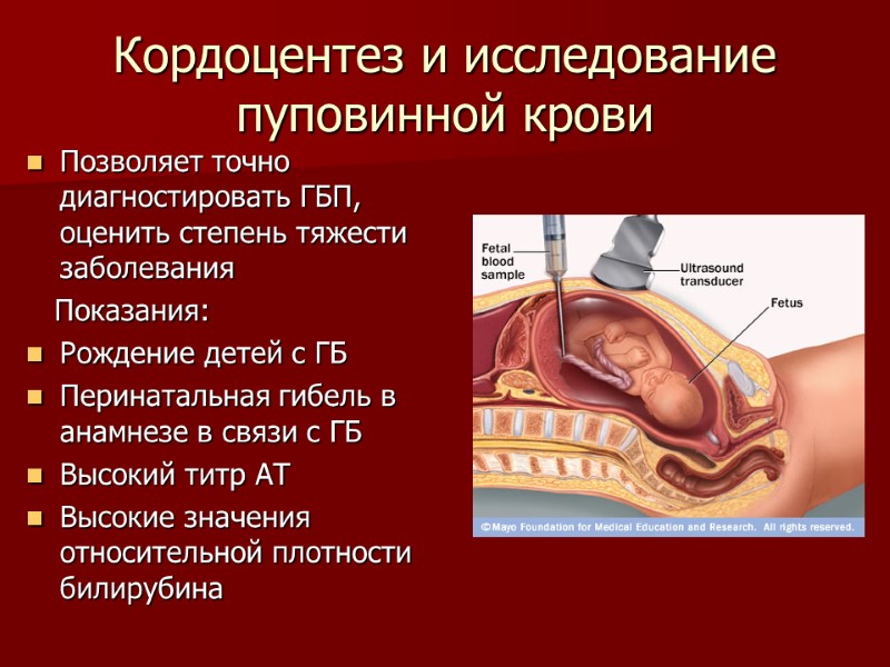 Кордоцентез и исследование пуповинной крови Позволяет точно диагностировать ГБП, оценить степень тяжести заболевания 